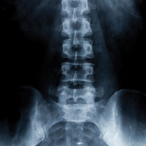 x-ray/fluoroscopy